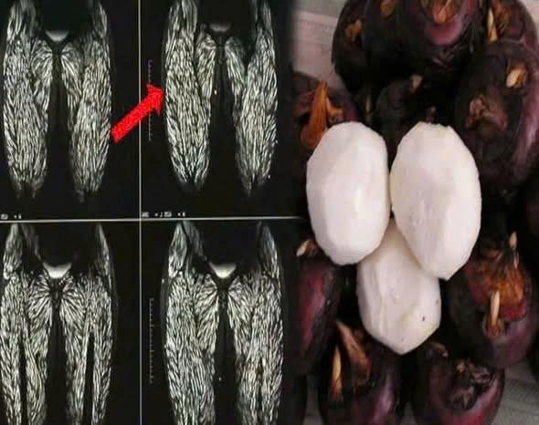 Ăn một miếng tương đương cho 100.000 con ký sinh trùng vào bụng ..