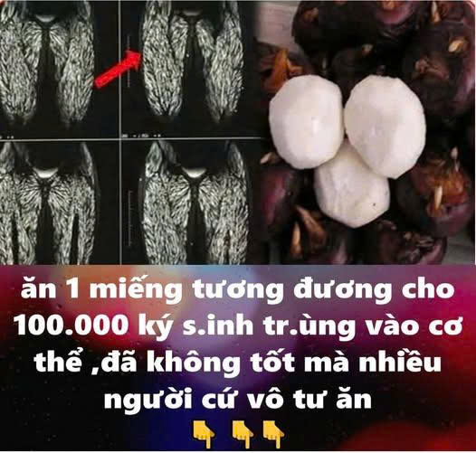 Ăn một miếng tương đương cho 100.000 con ký sinh trùng vào bụng